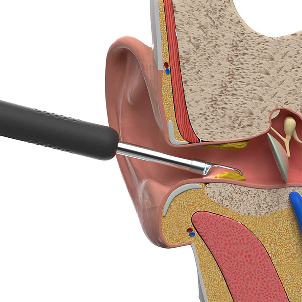 xiaomi bebird r1 smart ear wax remover tool